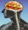 Epilepsy in Human 